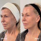 Comeback Glow™ | Facial Stick Serum