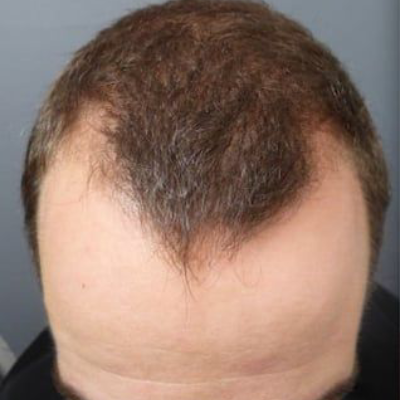 Jimmy — before