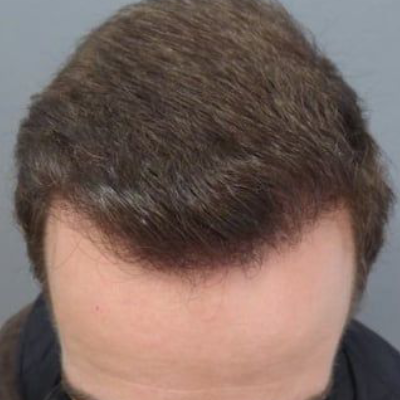 Jimmy — after